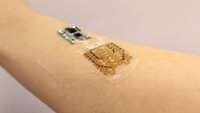 ستاد فرهنگسازی اقتصاد دانش بنیان Smart bandages designed to monitor and tailor treatment for chronic wounds 