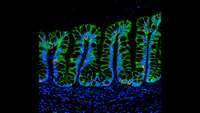 ستاد فرهنگسازی اقتصاد دانش بنیان Synthetic Hydrogels Deliver Cells to Repair Intestinal Injuries