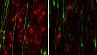 ستاد فرهنگسازی اقتصاد دانش بنیان Role of Astrocytes in Alexander Disease Revealed