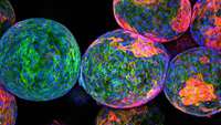 ستاد فرهنگسازی اقتصاد دانش بنیان Novel hope for stem cell approach to treat diabetes