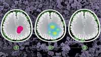 ستاد فرهنگسازی اقتصاد دانش بنیان A targeted approach to treating glioma