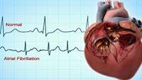 ستاد فرهنگسازی اقتصاد دانش بنیان UIC researchers create heart cells to study AFib 