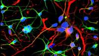 ستاد فرهنگسازی اقتصاد دانش بنیان Uncovering the early origins of Huntingtons disease