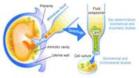 ستاد فرهنگسازی اقتصاد دانش بنیان Amniotic fluid stem cells ameliorate bladder dysfunction induced by chronic bladder ischemia in rat