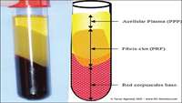 ستاد فرهنگسازی اقتصاد دانش بنیان Use of platelet-rich fibrin in regenerative dentistry: a systematic review.