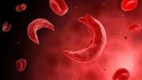 ستاد فرهنگسازی اقتصاد دانش بنیان Sickle-Cell Patients See Hope in CRISPR