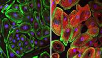 ستاد فرهنگسازی اقتصاد دانش بنیان CRISPR-Cpf1 correction of muscular dystrophy mutations in human cardiomyocytes and mice