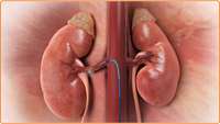 ستاد فرهنگسازی اقتصاد دانش بنیان Human stem cells used to cure renal anemia in mice