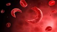 ستاد فرهنگسازی اقتصاد دانش بنیان Outcomes of Unrelated Donor Stem Cell Transplant with Post-Transplant Cyclophosphamide for Graft- Versus-Host Disease Prophylaxis in Patients with Severe Sickle Cell Disease.