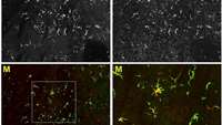 ستاد فرهنگسازی اقتصاد دانش بنیان A new gene therapy transplantation technique could improve treatment of neurodegenerative diseases