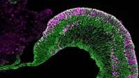 ستاد فرهنگسازی اقتصاد دانش بنیان An Eye Organoid Approach Identifies Six3 Suppression of R-spondin 2 as a Critical Step in Mouse Neuroretina Differentiation