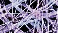 ستاد فرهنگسازی اقتصاد دانش بنیان 3-D printed microfibers could provide structure for artificially grown body part