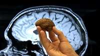 ستاد فرهنگسازی اقتصاد دانش بنیان Mini brains may wrinkle and fold just like ours