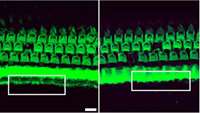 ستاد فرهنگسازی اقتصاد دانش بنیان Gene editing staves off deafness in mice