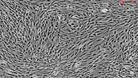 ستاد فرهنگسازی اقتصاد دانش بنیان Mesenchymal stromal cells for tolerance induction in organ transplantation