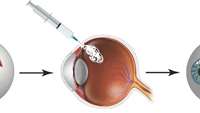 ستاد فرهنگسازی اقتصاد دانش بنیان Combating eye injuries with a reversible superglue seal