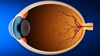 ستاد فرهنگسازی اقتصاد دانش بنیان GenSight Receives UK Approval to Start Phase I/II Trial of Gene Therapy for Retinitis Pigmentosa