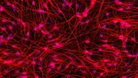 ستاد فرهنگسازی اقتصاد دانش بنیان Altering Huntington’s disease patients’ skin cells into brain cells sheds light on disorder