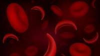 ستاد فرهنگسازی اقتصاد دانش بنیان Two Types of CRISPR Gene Editing Could Be Useful in Treating Sickle Cell Anemia, Editas Reports