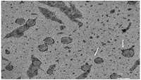 ستاد فرهنگسازی اقتصاد دانش بنیان Stem-cell based stroke treatment repairs brain tissue