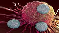 ستاد فرهنگسازی اقتصاد دانش بنیان Sorrento Therapeutics Autologous Anti-CEA CAR-T Cell Therapy for Liver Metastases Demonstrates Therapeutic Activity in Stage IV Pancreas Cancer in a Phase 1b HITM-SURE Trial