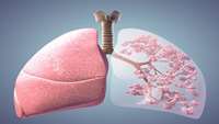 ستاد فرهنگسازی اقتصاد دانش بنیان New-found stem cell helps regenerate lung tissue after acute injury