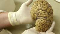 ستاد فرهنگسازی اقتصاد دانش بنیان Scientists Restore Some Function In The Brains Of Dead Pigs