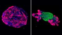 ستاد فرهنگسازی اقتصاد دانش بنیان Johns Hopkins Researchers Create Novel Cell Model of Aging-Related Colon Cancer Risk