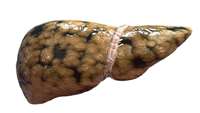 ستاد فرهنگسازی اقتصاد دانش بنیان Fatty liver disease research set to benefit from stem cell advance