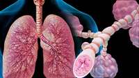 ستاد فرهنگسازی اقتصاد دانش بنیان Multiple Doses of Stem Cells Show Potential in Treating Severe Asthma