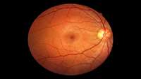 ستاد فرهنگسازی اقتصاد دانش بنیان    Team identifies developmental stage for no. 1 eye tumor in children