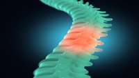 ستاد فرهنگسازی اقتصاد دانش بنیان A recipe for regenerating nerve fibers across complete spinal cord injury