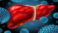 ستاد فرهنگسازی اقتصاد دانش بنیان Liver cancer patients can be treated for Hep C infection