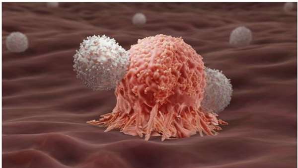  Iranian Stem Cell Counil CAR T therapy exhibits encouraging proficiency in R/R LBCL