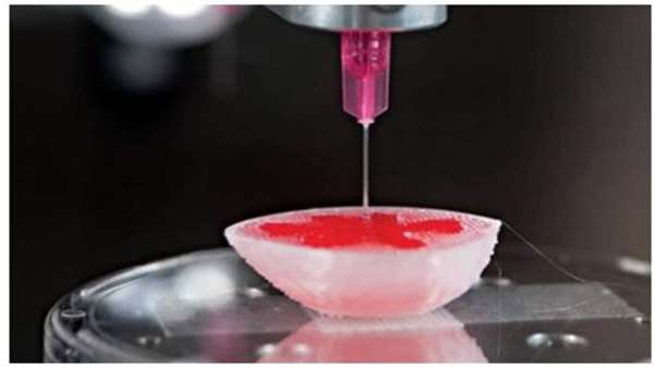  Iranian Stem Cell Counil Uniink: A new 3D bioprinted cell therapy approach for Type 1 diabetes